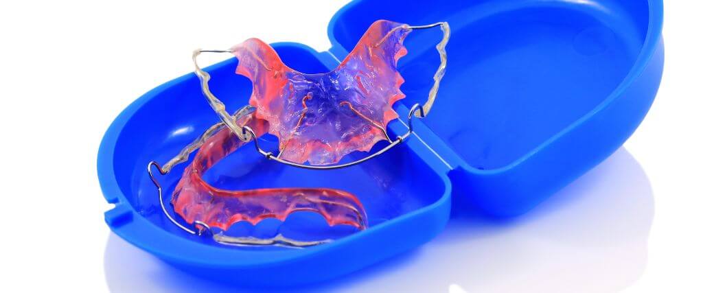 5 Signs It’s Time to Replace Your Retainer