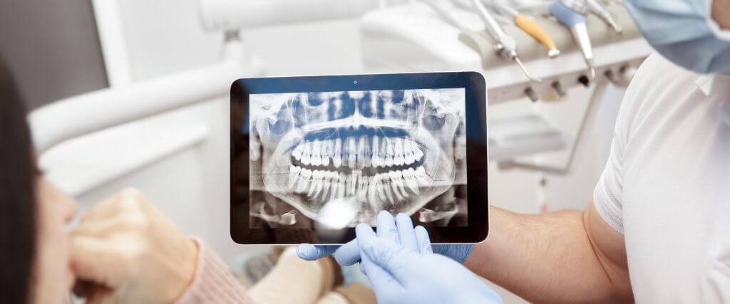 Are Dental X-Rays Safe