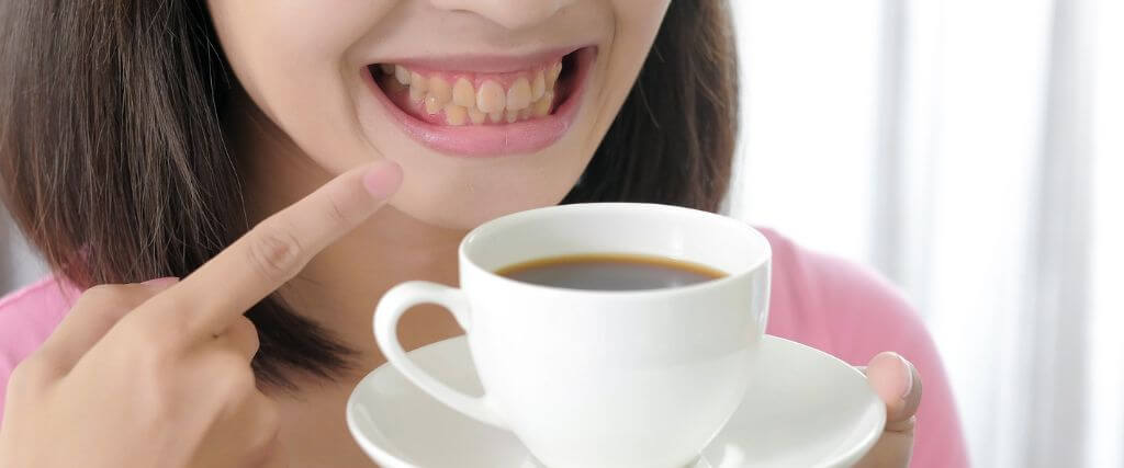 Common Causes of Tooth Discoloration