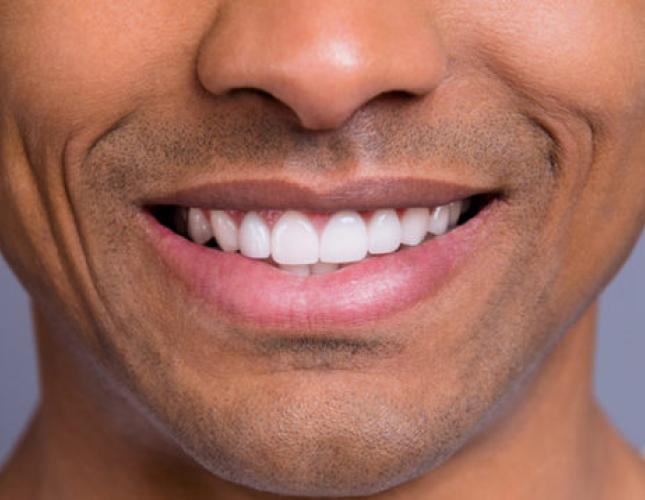 Teeth Whitening Can Provide the Smile You’ve Always Wanted