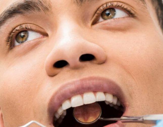 Congenital Aglossia: The Rare Condition of Absence of the Tongue