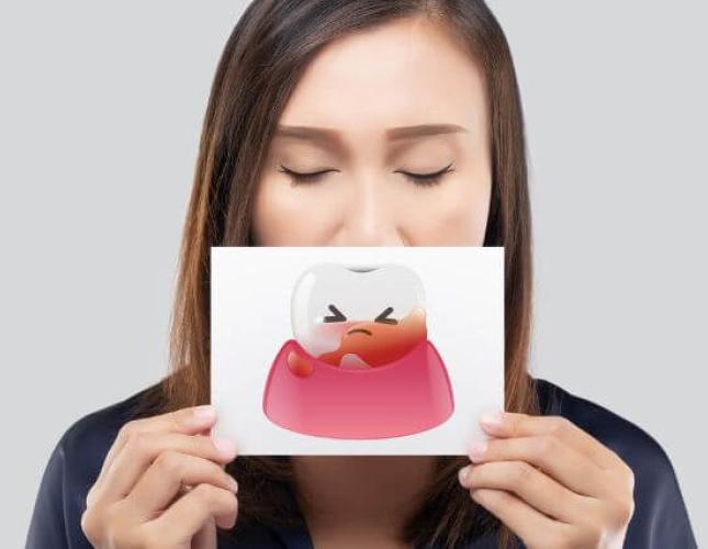 Emergency Dental Care: What to Do When a Dental Problem Can't Wait